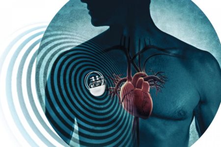 Gli hacker colpiscono anche i pacemaker