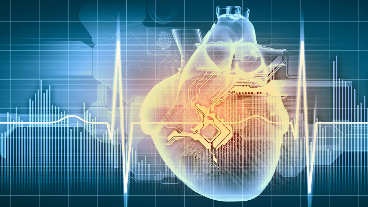 Jetson, a device that recognises people through the heart beat