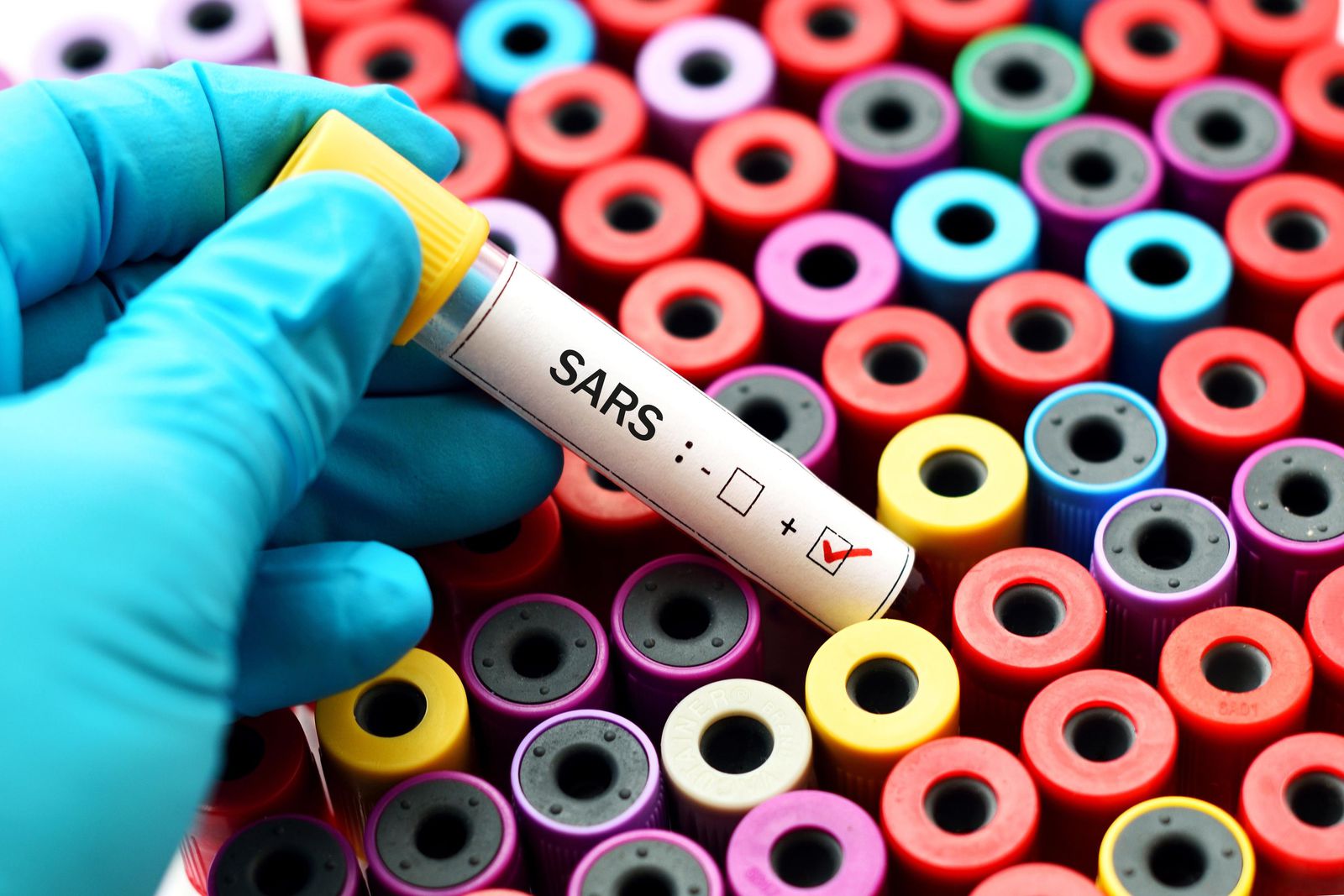 Scientific research can - and will - defeat viruses