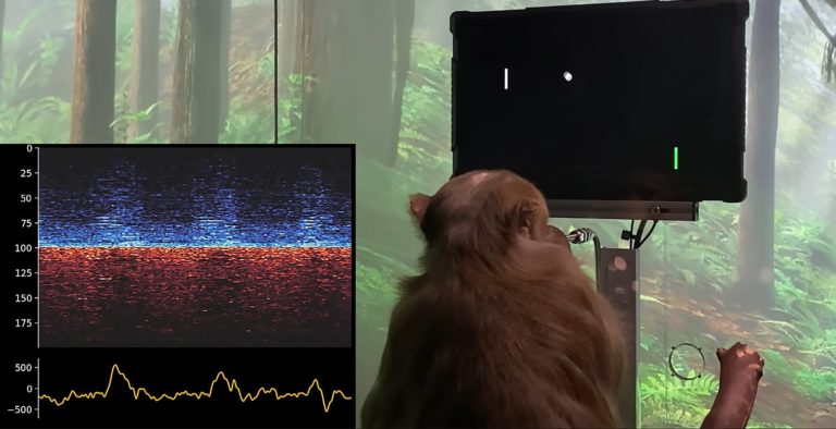 Neuralink