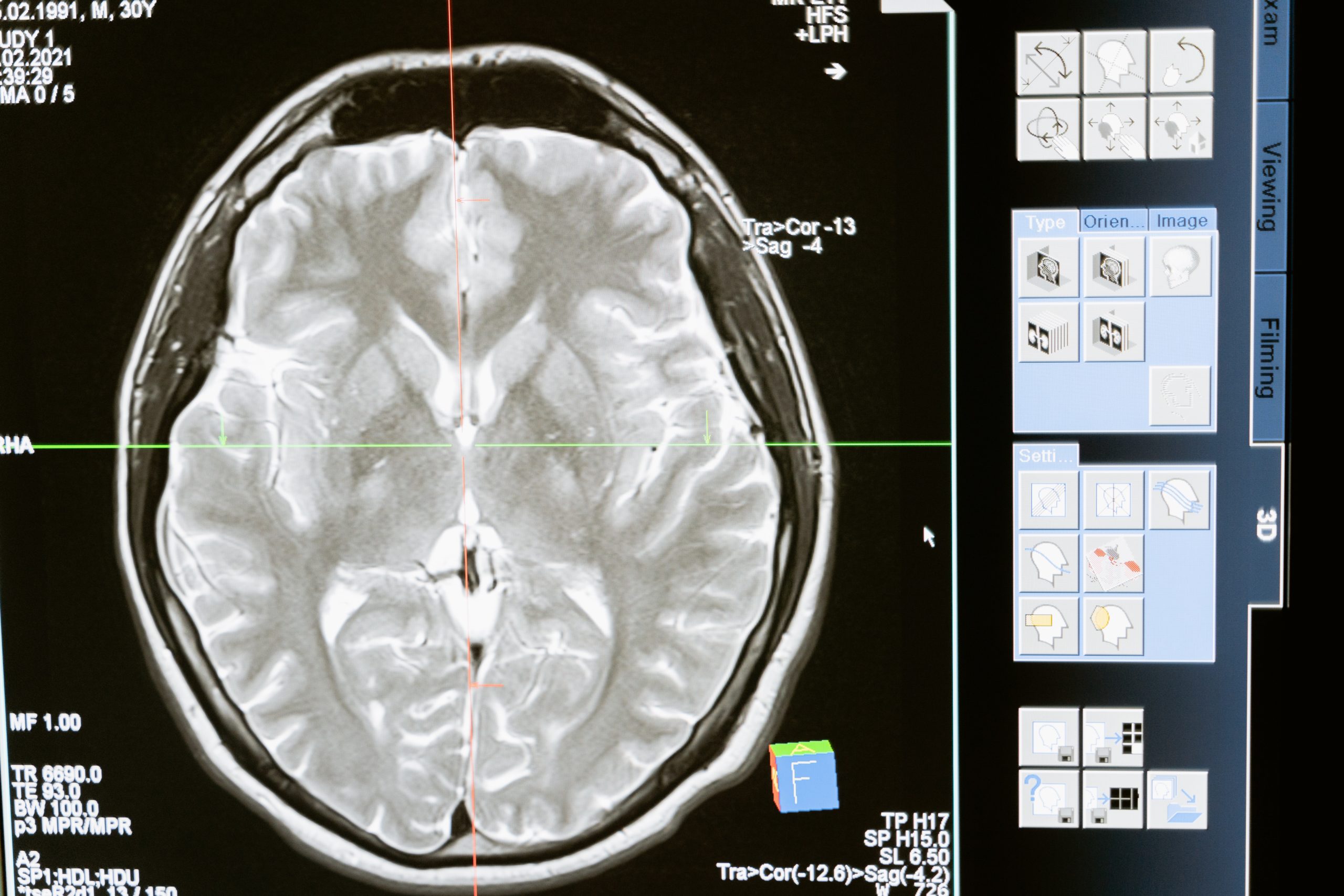 dispositivo neuromorfico e idroni