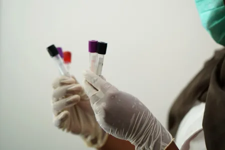 Proteina Claudina 18: nuovo biomarcatore tumorale